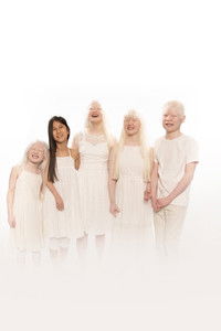 Born with Albinism